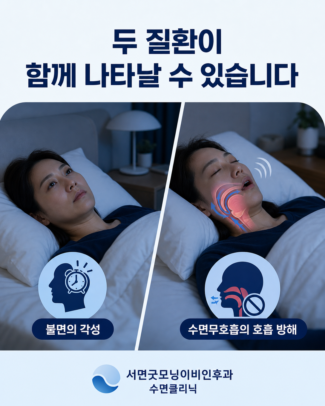 잠들기 어려운 불면 증상과 수면 중 기도 폐쇄가 한 환자에게 함께 나타날 수 있음을 보여주는 이미지