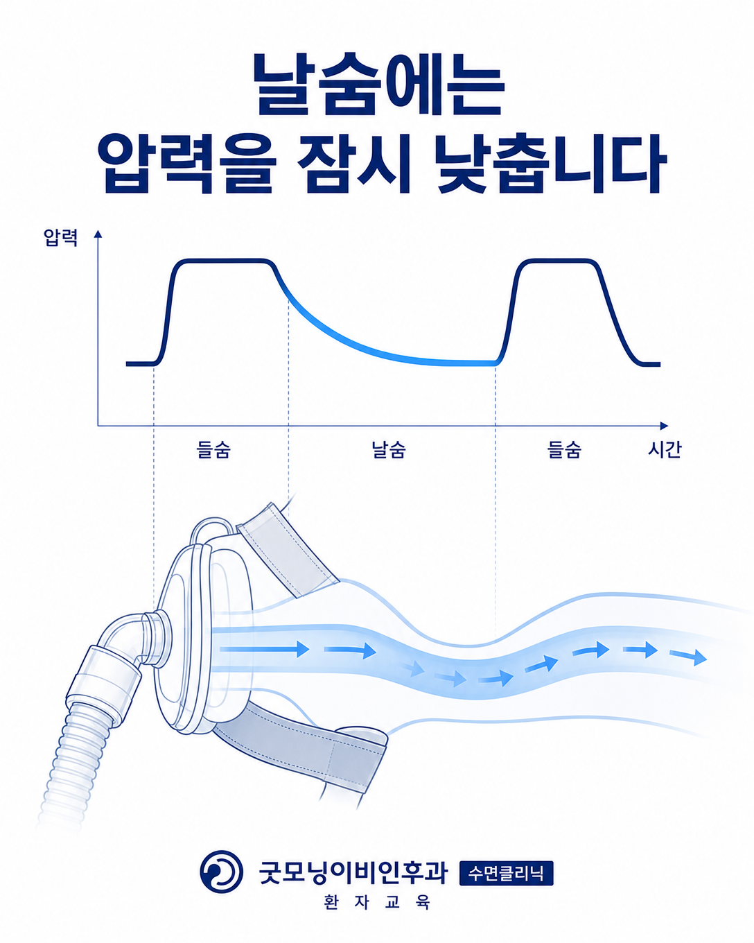 양압기 사용 중 날숨 구간의 압력을 일시적으로 낮추는 호기압 완화 기능 도식
