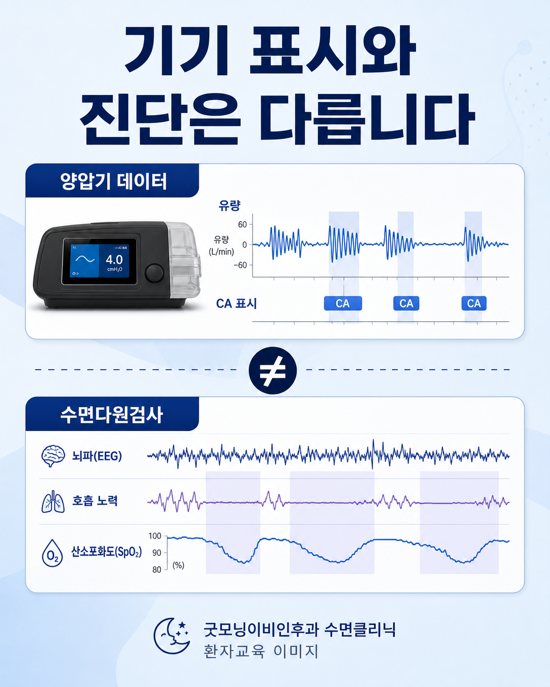 양압기 자동 감지 데이터와 수면다원검사의 측정 항목 차이