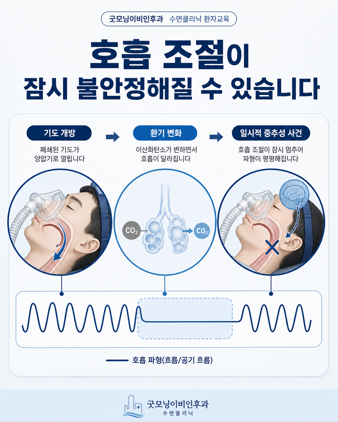 양압기 치료 중 호흡 조절 변화로 중추성 사건이 나타날 수 있는 기전
