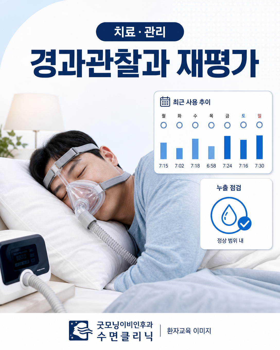 양압기 사용 데이터를 여러 날 관찰하며 누출과 증상을 점검하는 과정