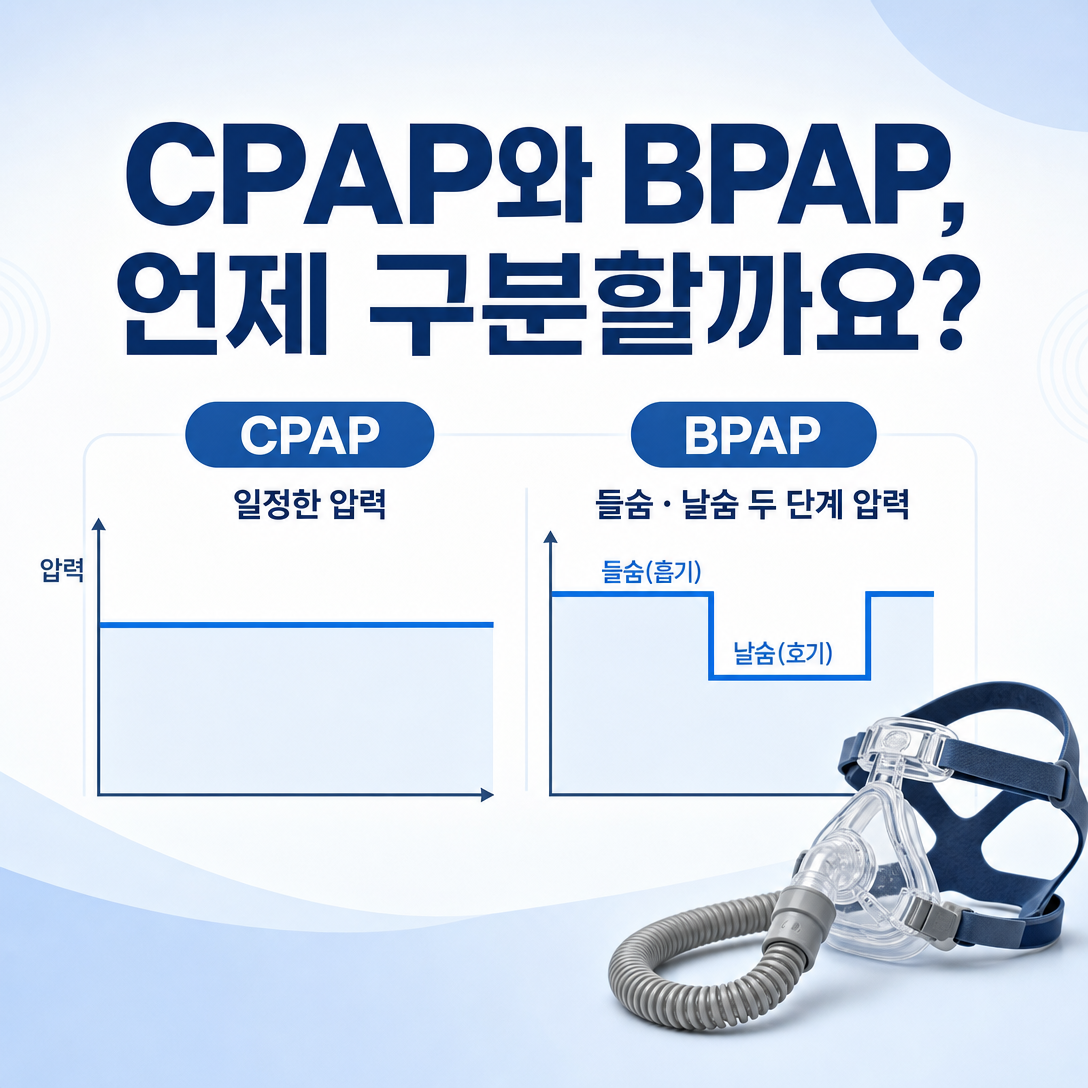 일반 양압기 CPAP와 이중압력 양압기 BPAP의 압력 방식 차이를 보여주는 대표 이미지