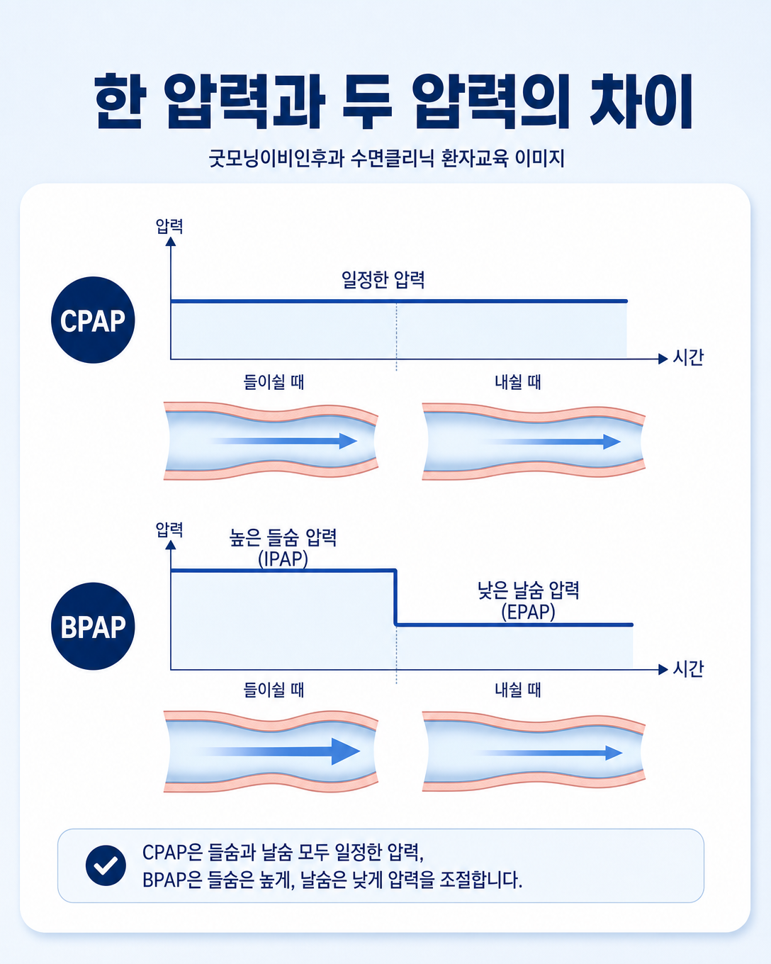 CPAP의 한 가지 압력과 BPAP의 들숨·날숨 두 압력을 비교한 인포그래픽