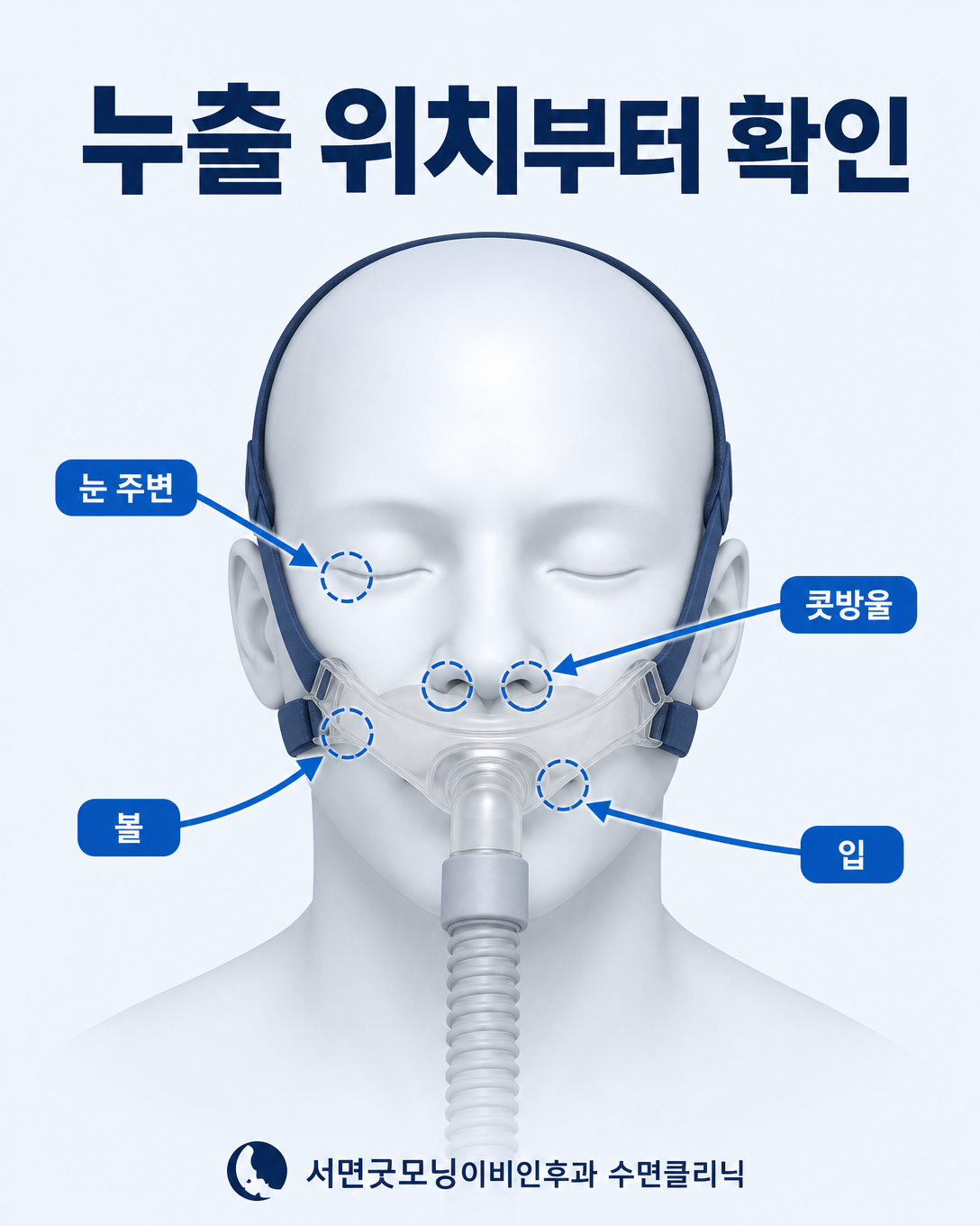 양압기 마스크의 눈 주변, 콧방울, 볼과 입 누출 위치를 확인하는 도식