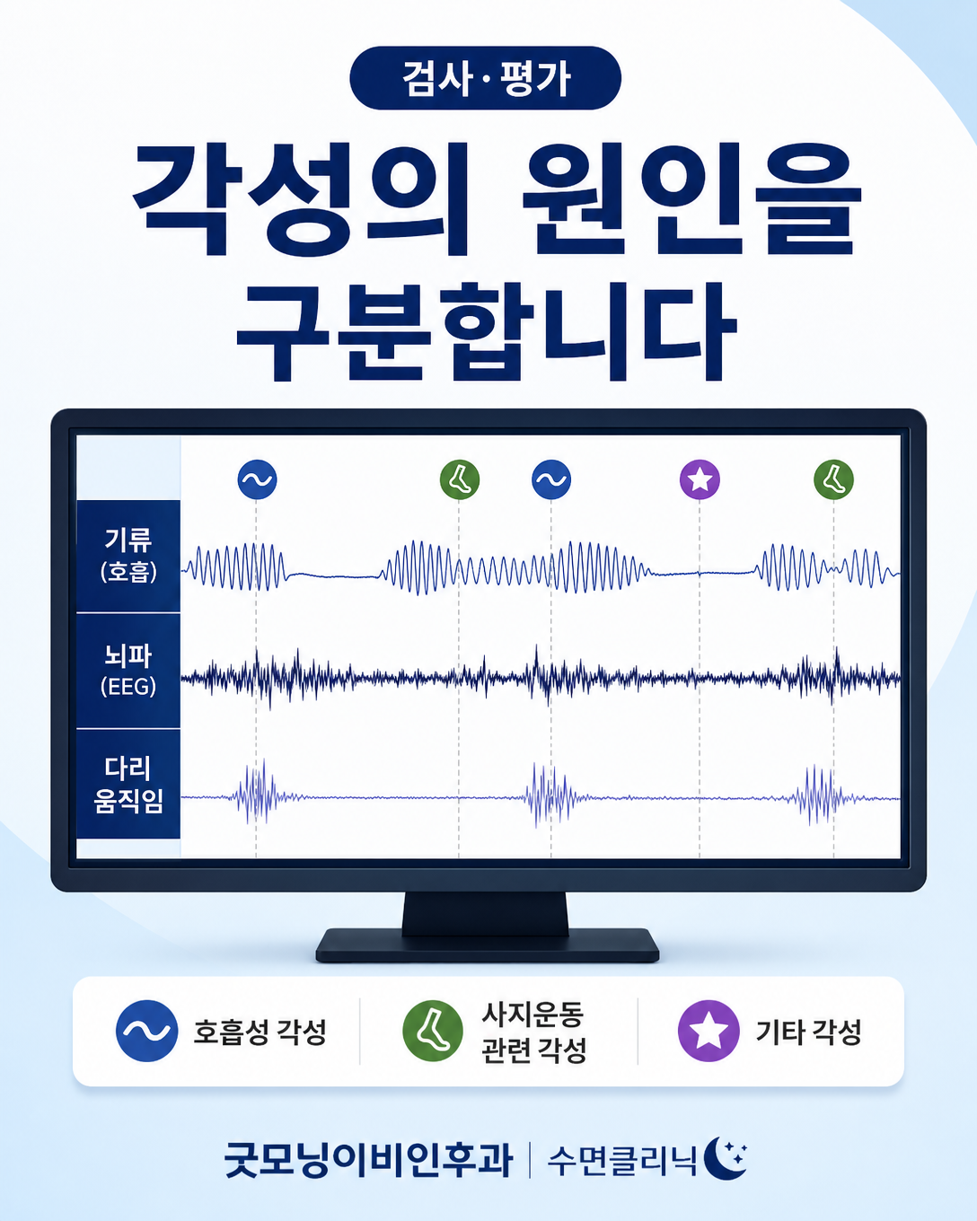 수면다원검사에서 기류와 뇌파, 다리 움직임 신호를 비교해 각성 원인을 구분하는 화면