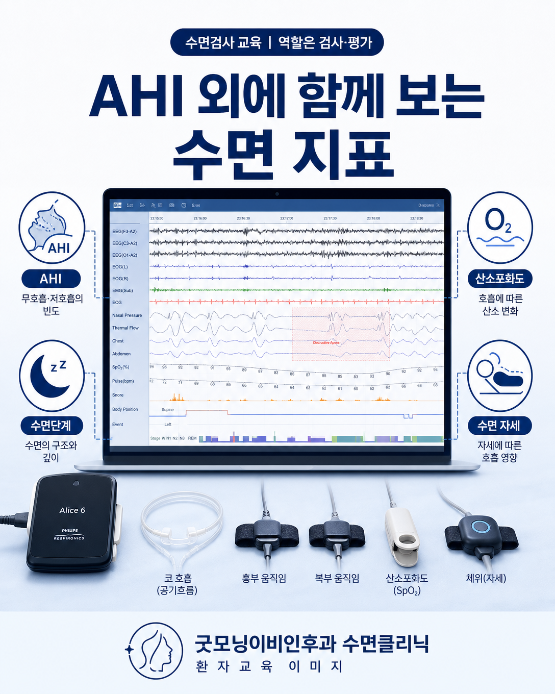 수면다원검사에서 AHI와 함께 산소포화도, 수면단계와 자세를 확인하는 과정