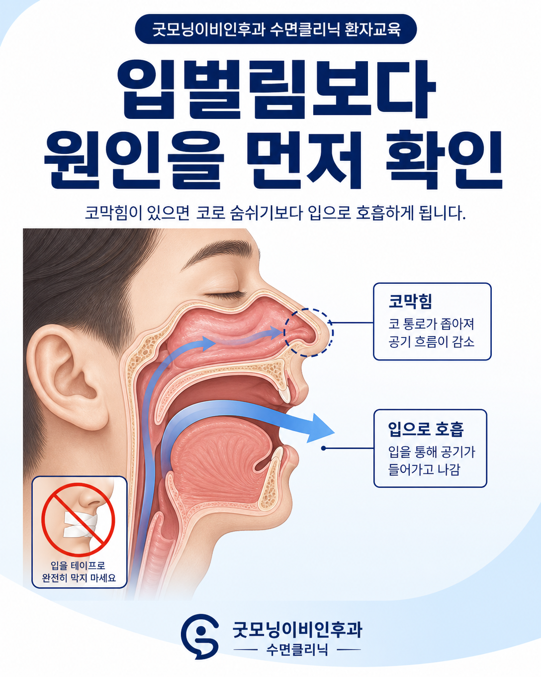 코막힘과 입호흡의 관계 및 입을 막기 전에 원인을 확인해야 함을 설명하는 기도 도식