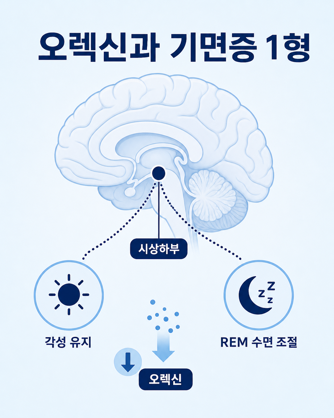 각성과 REM수면 조절에 관여하는 오렉신과 기면증 1형의 관계를 보여주는 뇌 도식