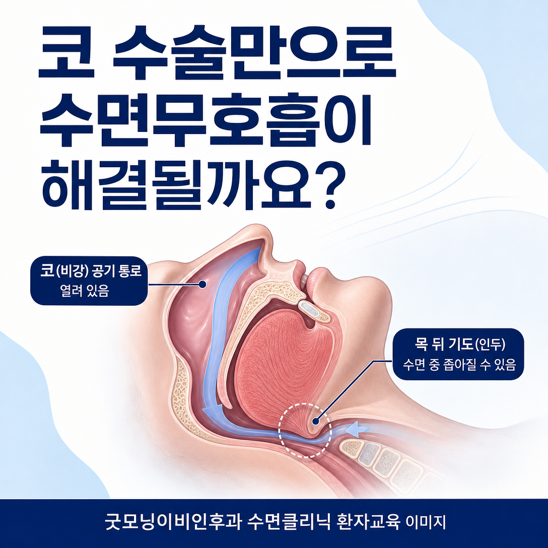 코 수술의 코호흡 개선과 수면무호흡 치료 효과가 다름을 보여주는 대표 이미지