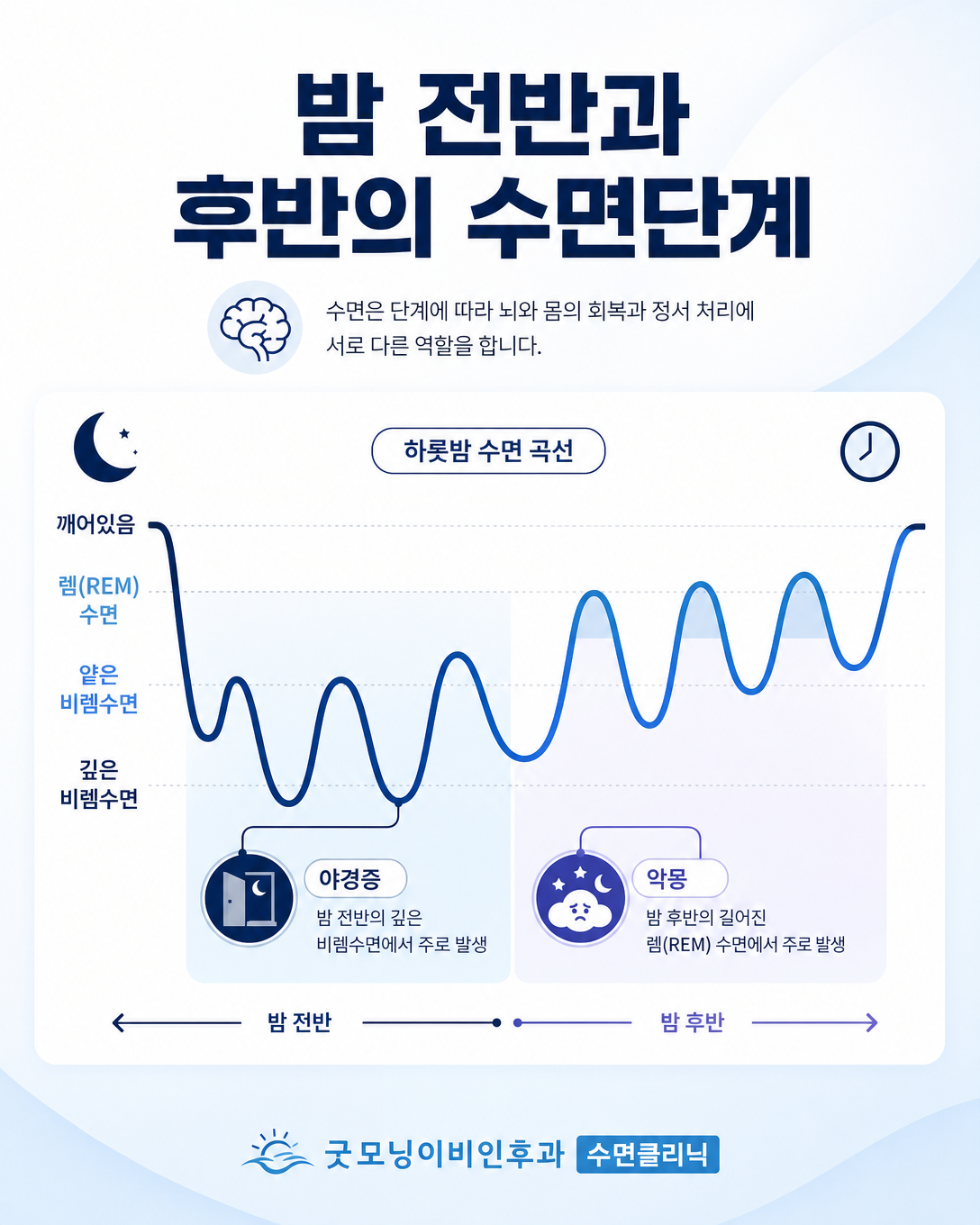 밤 전반의 깊은 비렘수면 야경증과 밤 후반의 렘수면 악몽을 비교한 수면단계 도식