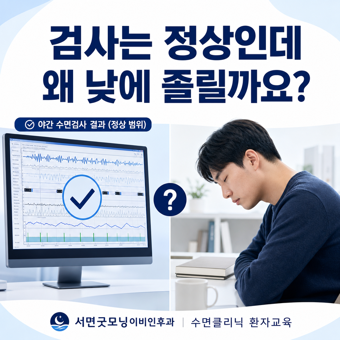 수면다원검사 결과는 정상이지만 낮 졸림이 지속되는 상황을 보여주는 대표 이미지