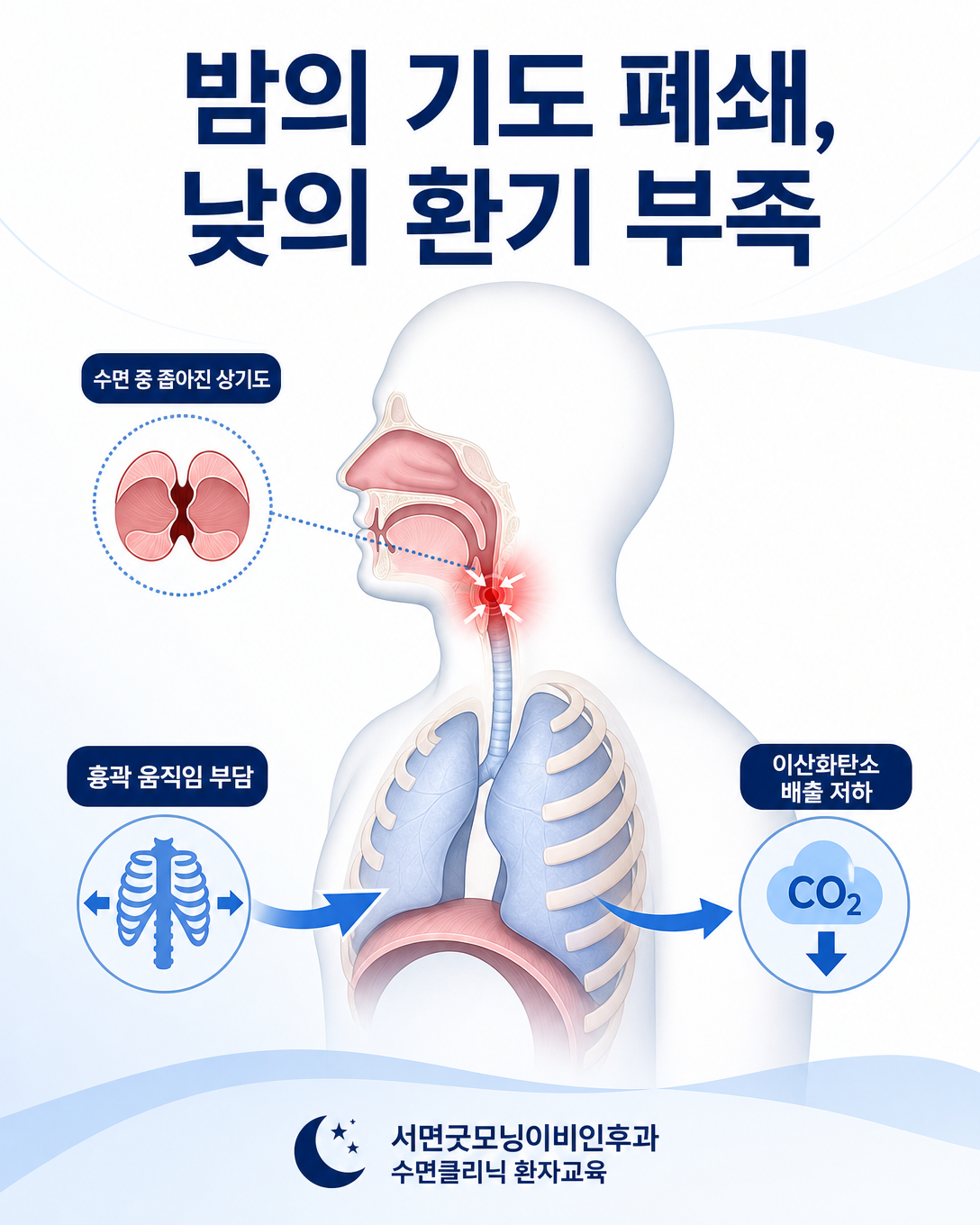 수면 중 상기도 폐쇄와 비만으로 인한 흉곽 움직임 부담 및 이산화탄소 축적 기전