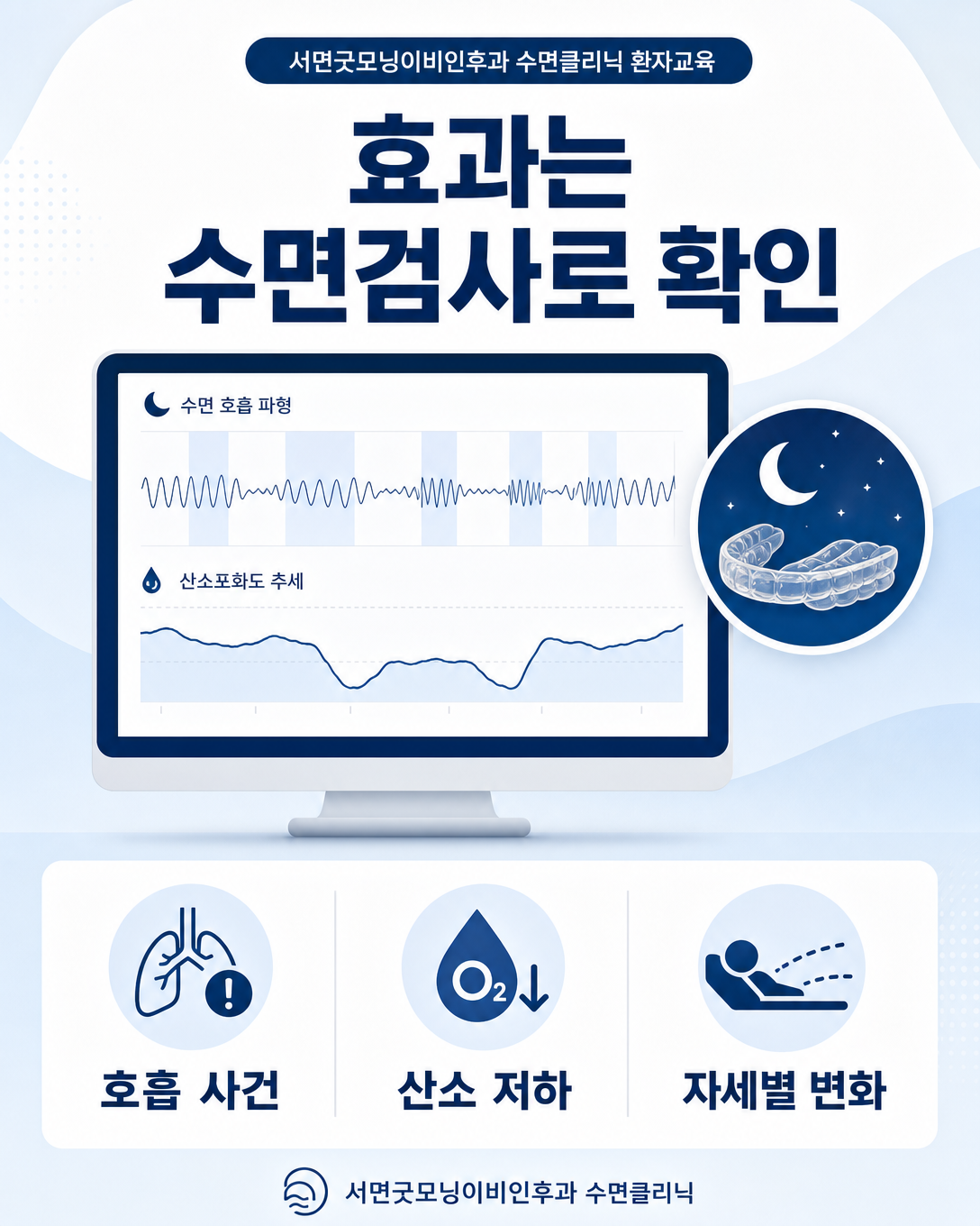 구강장치 착용 후 수면검사로 호흡 사건과 산소 저하 및 자세별 변화를 확인하는 모습
