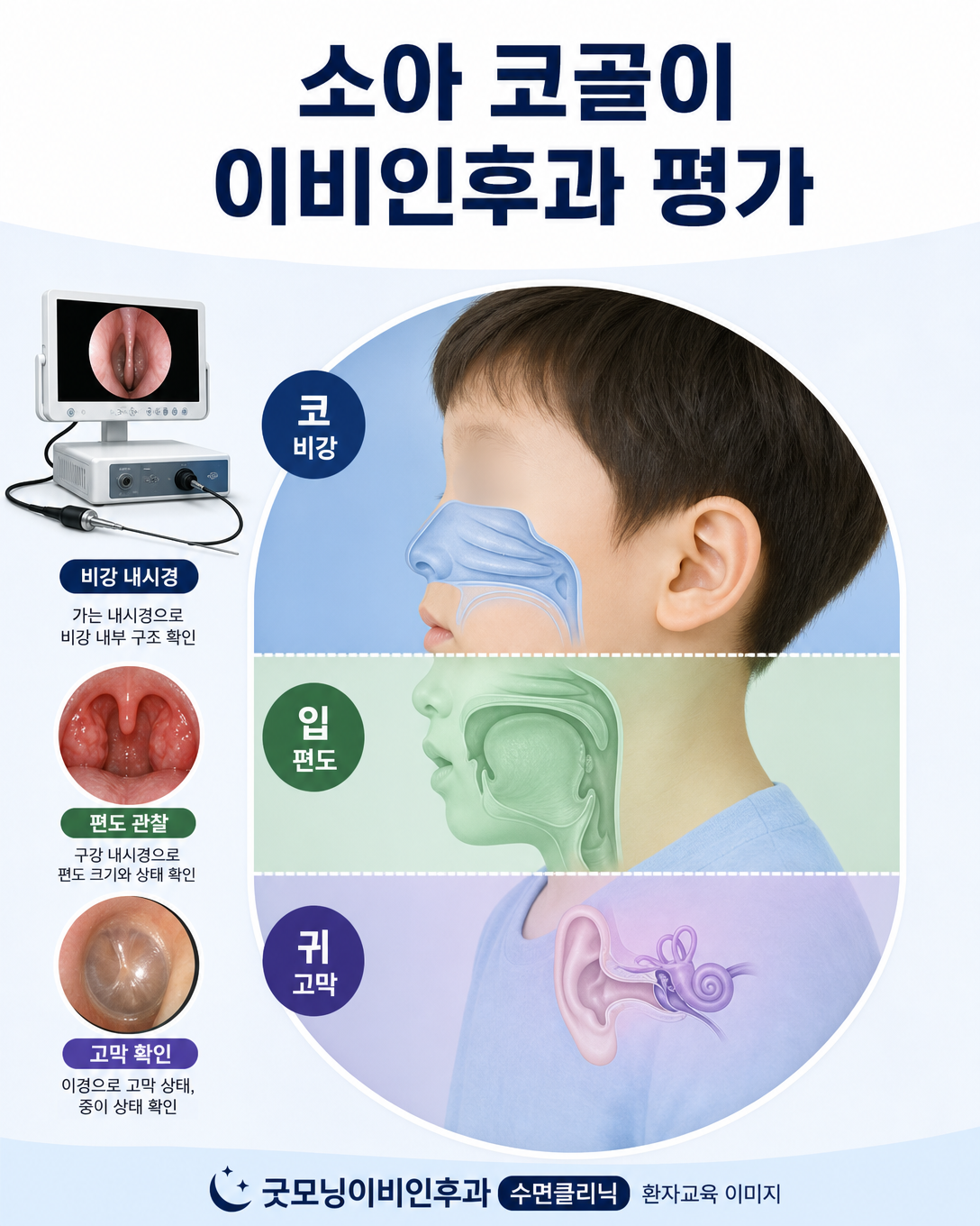 소아 코골이 진료에서 코, 편도, 아데노이드와 귀 상태를 평가하는 항목
