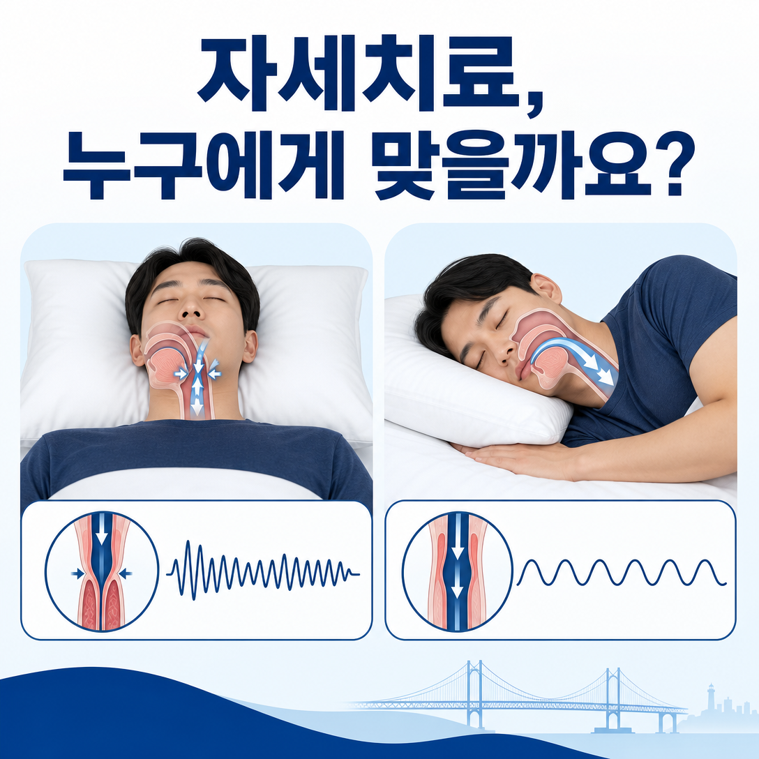 자세 의존성 수면무호흡증에서 바로 누운 자세와 옆으로 누운 자세의 호흡 차이를 보여주는 대표 이미지
