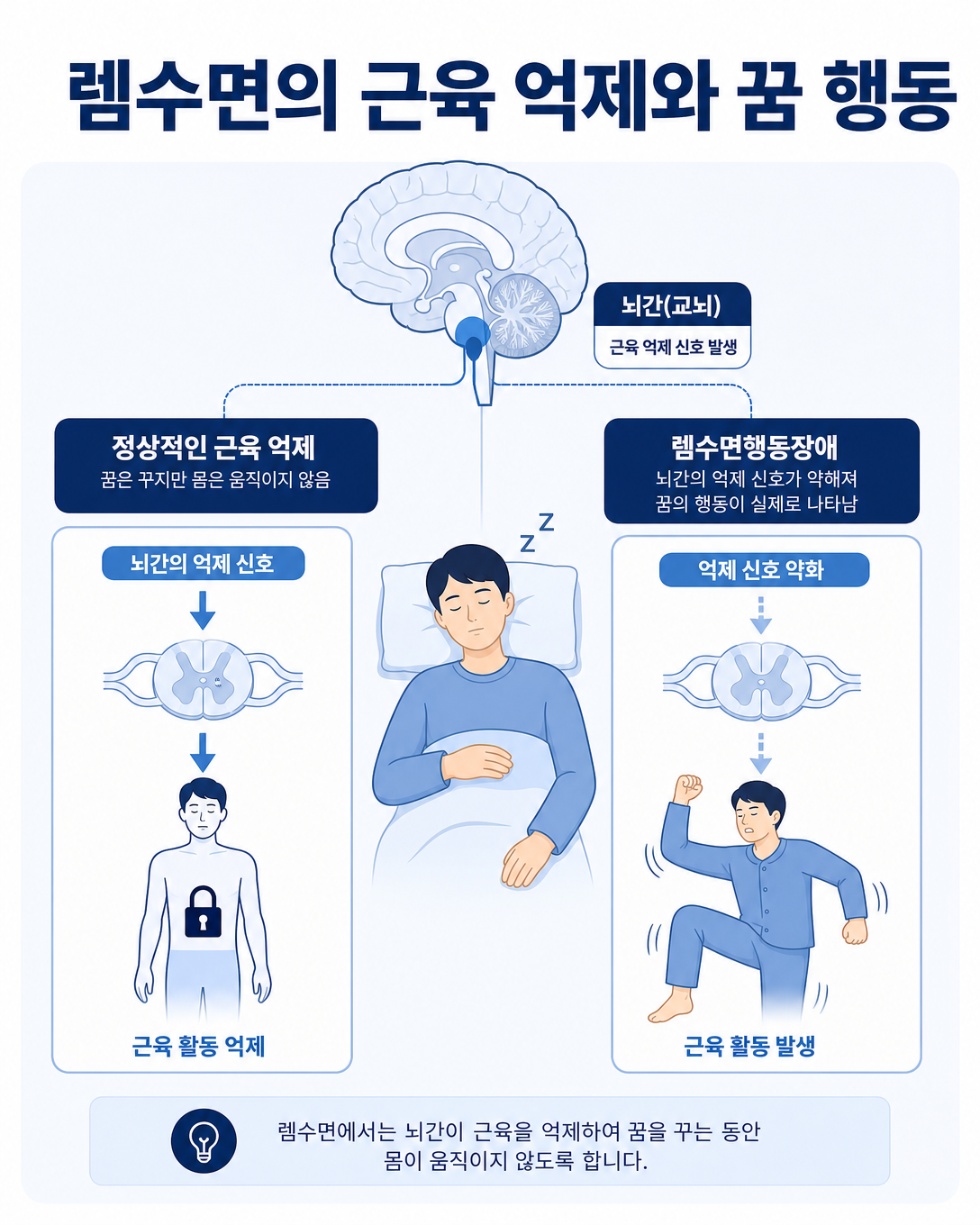 렘수면 중 근육 억제 소실과 꿈 행동 발생 기전을 설명하는 인포그래픽