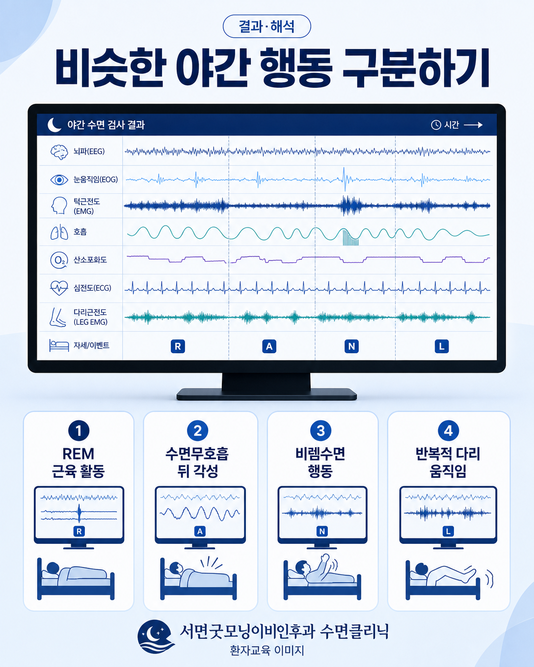 렘수면행동장애와 수면무호흡 및 다른 야간 행동의 검사 소견을 구분하는 도식