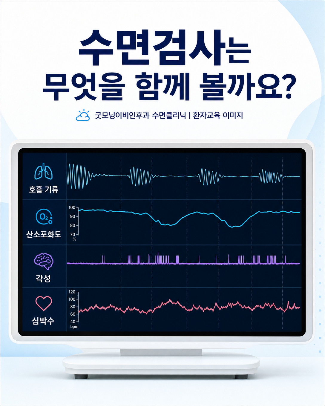 수면다원검사에서 호흡 기류와 산소포화도, 각성, 심박수를 함께 확인하는 모습