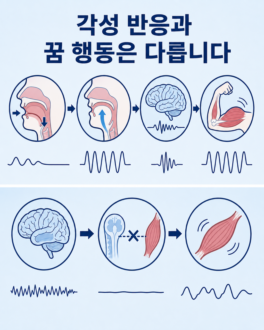 수면무호흡 각성 반응과 렘수면행동장애의 발생 기전을 비교한 도식