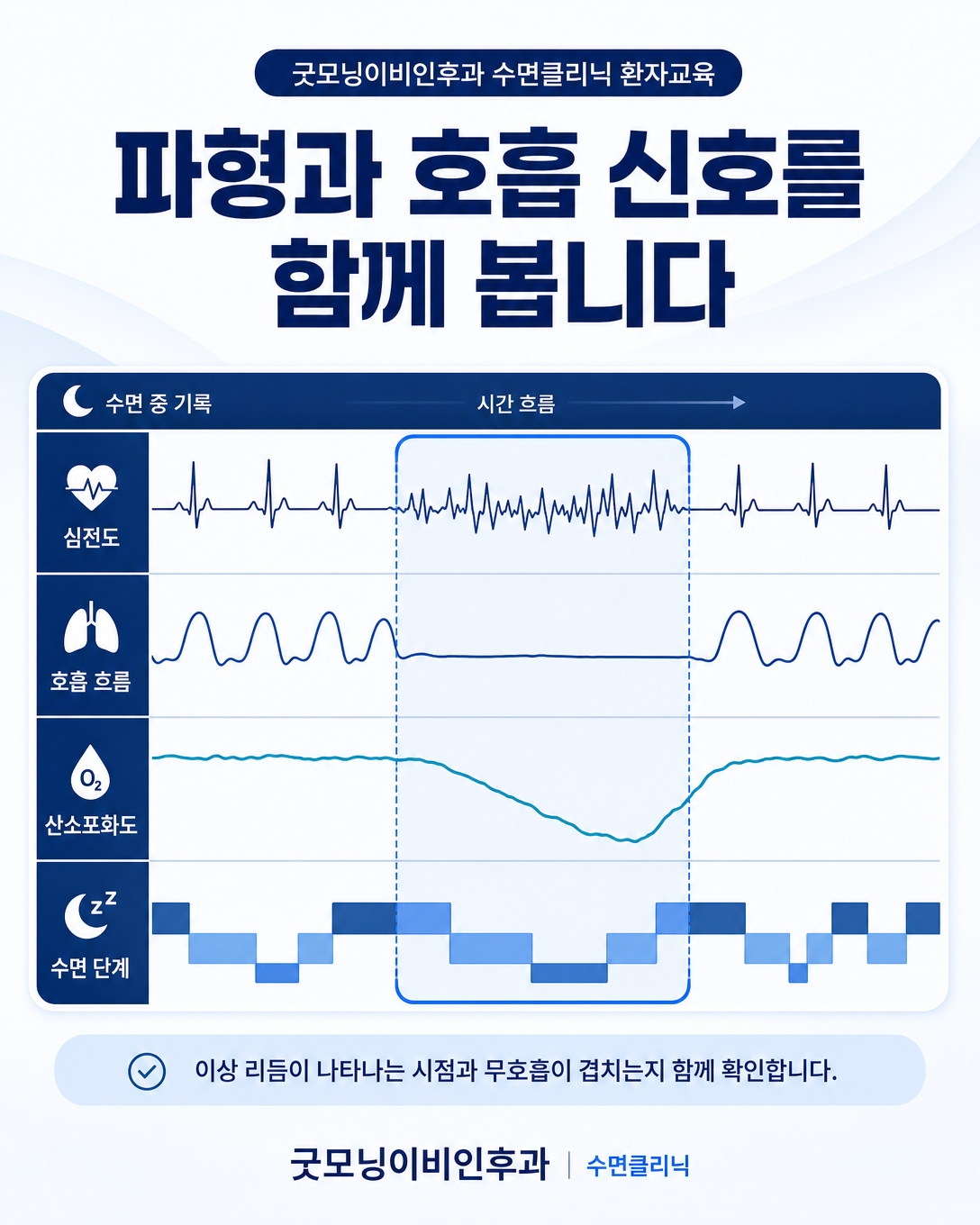 심전도와 호흡 및 산소포화도 파형을 같은 시간축에서 함께 해석하는 방법