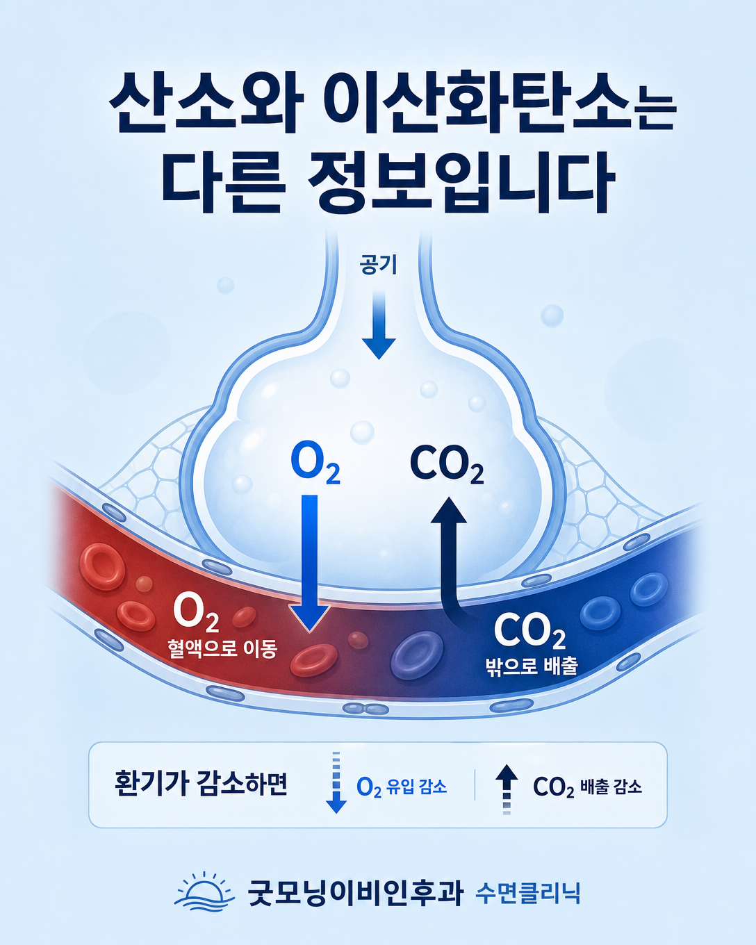 폐에서 산소가 흡수되고 이산화탄소가 배출되는 과정과 저환기 기전