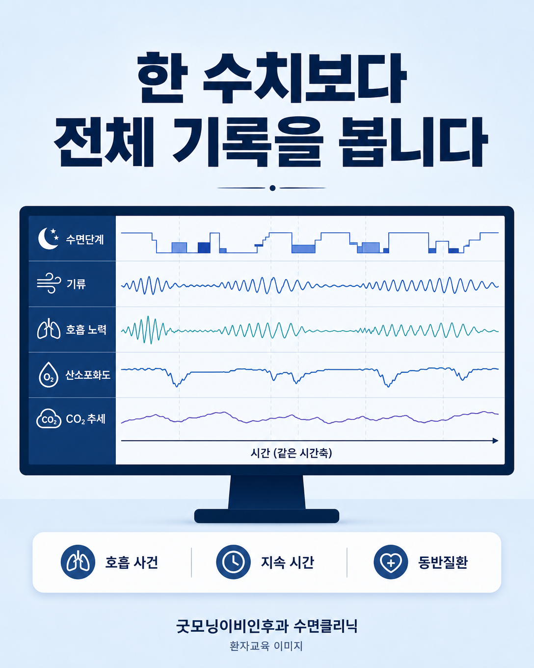 수면단계와 호흡, 산소포화도 및 이산화탄소 추세를 함께 해석하는 검사 화면