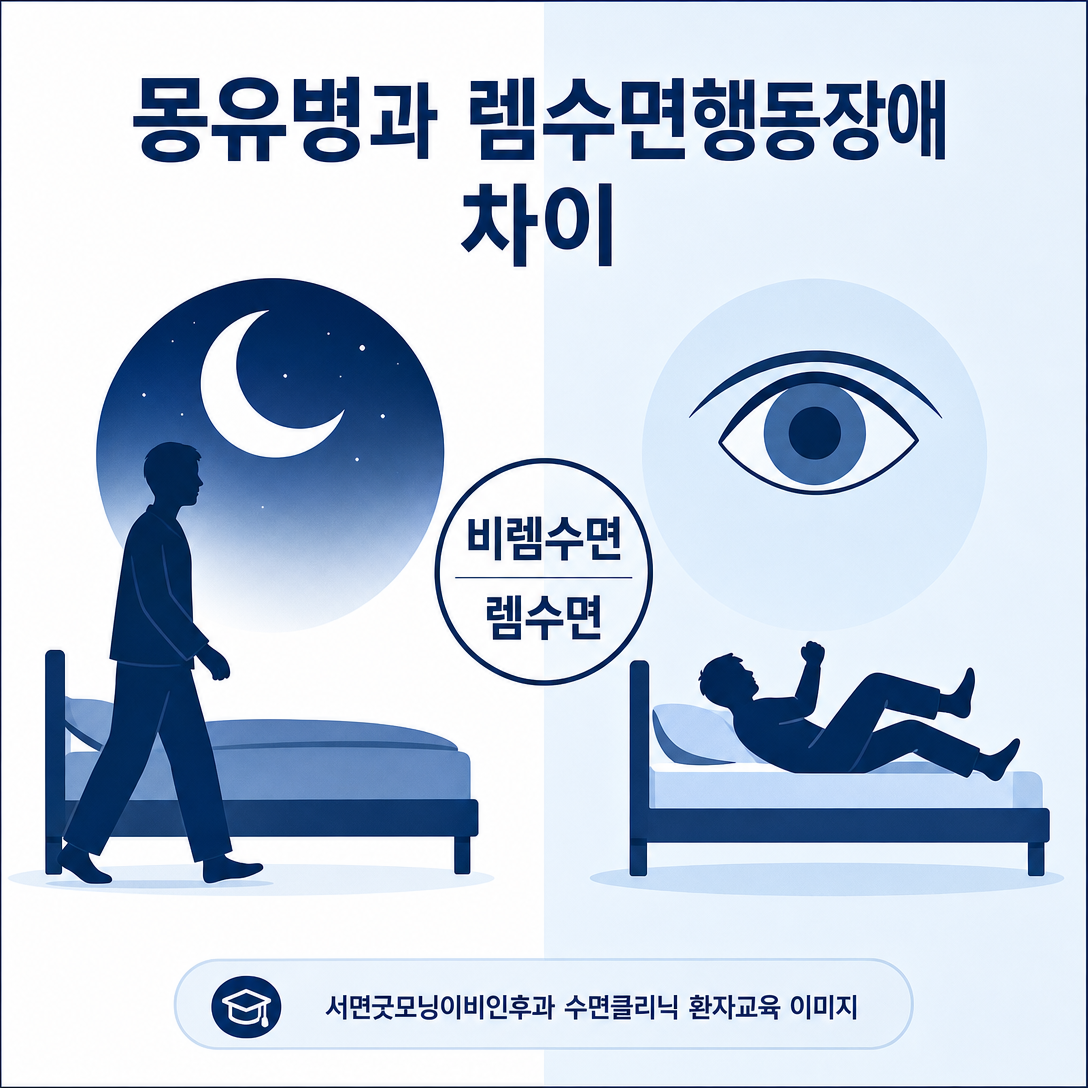 몽유병은 깊은 비렘수면, 렘수면행동장애는 렘수면에서 발생하는 차이를 보여주는 비교 이미지
