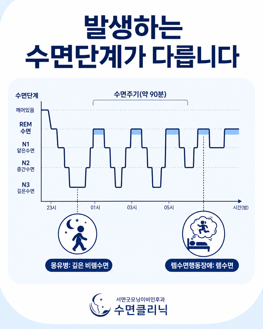 밤 전반 깊은 비렘수면의 몽유병과 밤 후반 렘수면의 렘수면행동장애를 나타낸 수면주기 도식