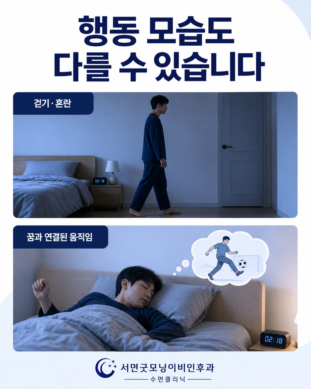 잠결에 걷는 몽유병 행동과 꿈에 따라 팔다리를 움직이는 렘수면행동장애 행동 비교