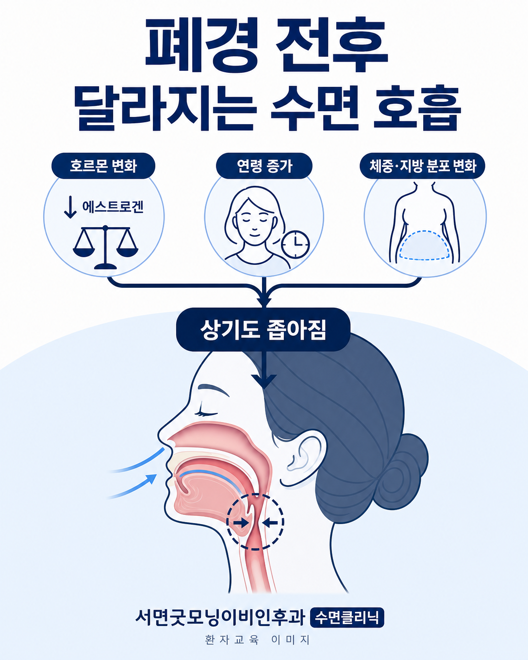 폐경 전후 호르몬과 연령 및 체중 변화가 수면 중 상기도 호흡에 미치는 영향