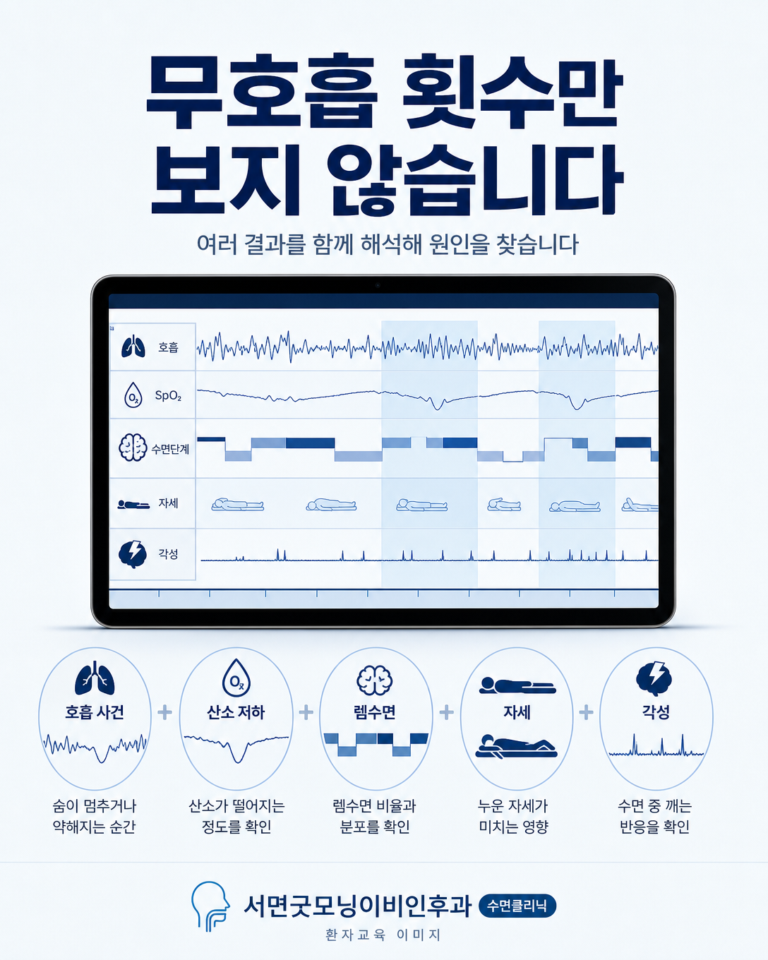 호흡 사건 산소포화도 수면단계 자세 각성을 함께 보는 수면검사 결과 해석