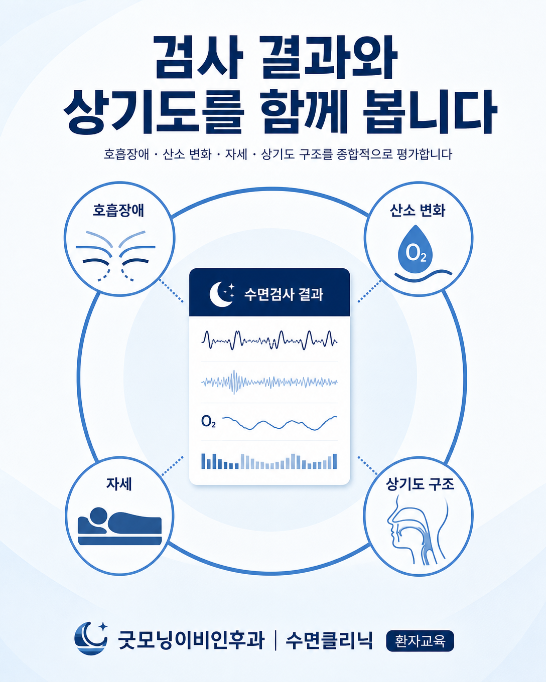 수면다원검사 결과와 편도·연구개·혀·턱 구조를 함께 해석하는 과정을 보여주는 인포그래픽