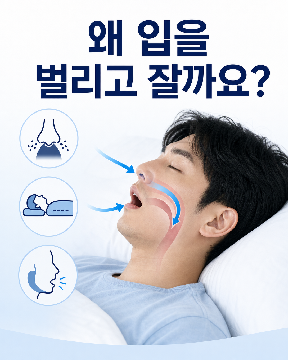 코막힘과 자세, 턱 벌어짐 등 성인이 입을 벌리고 자는 원인을 설명한 이미지