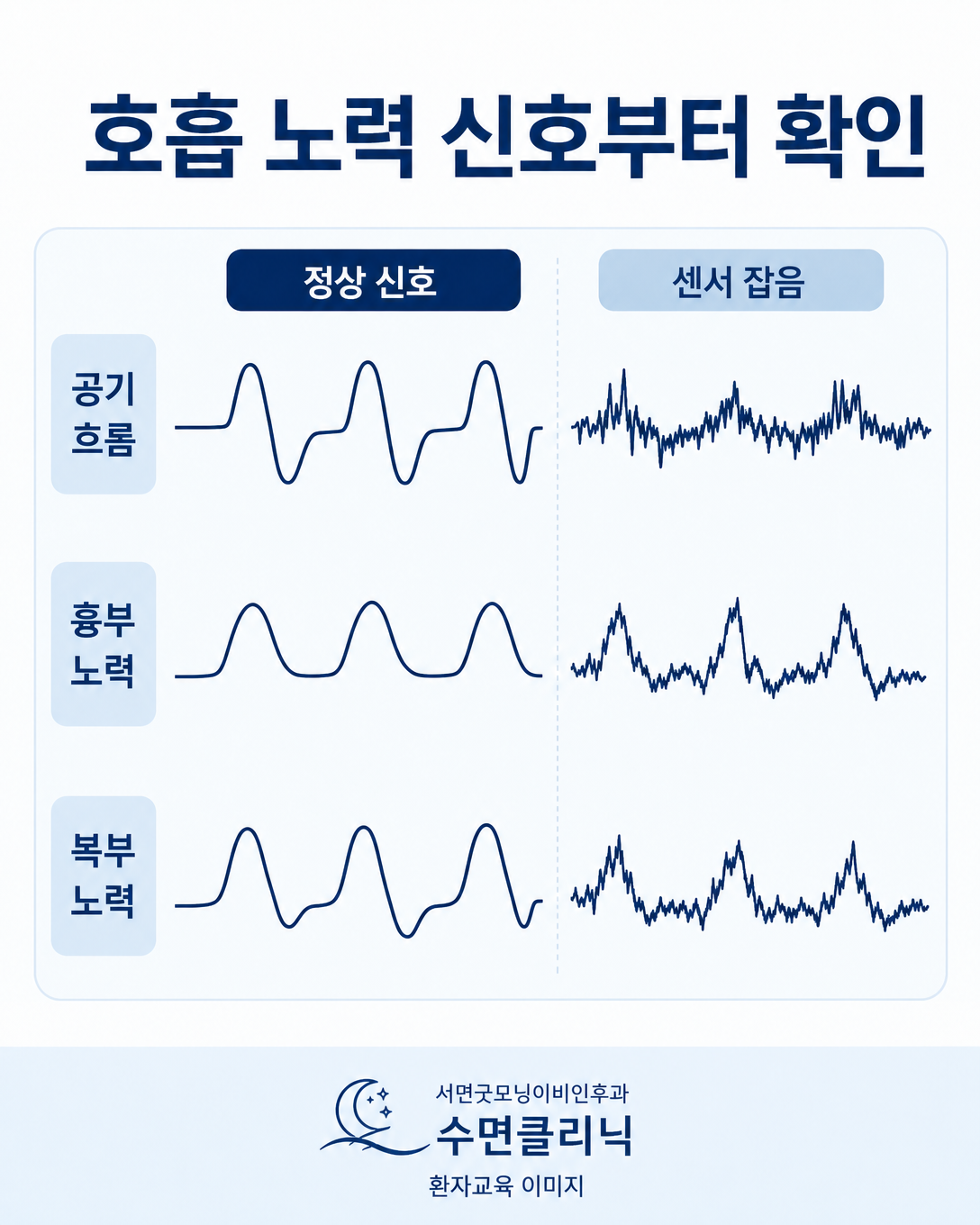 공기 흐름과 흉부·복부 호흡 노력 신호를 함께 재검토하는 과정