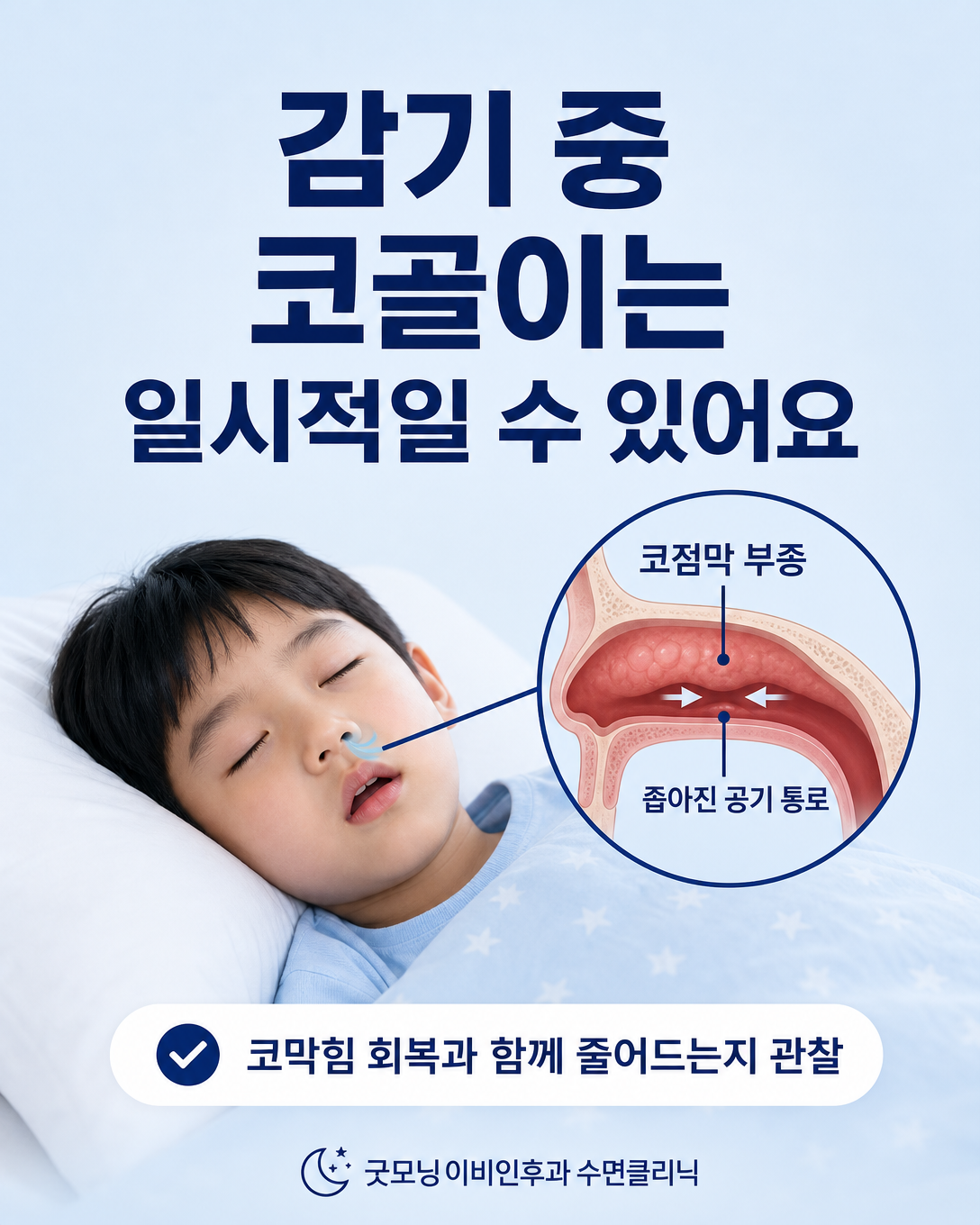 감기로 인한 코막힘과 일시적인 소아 코골이의 관계를 설명하는 이미지