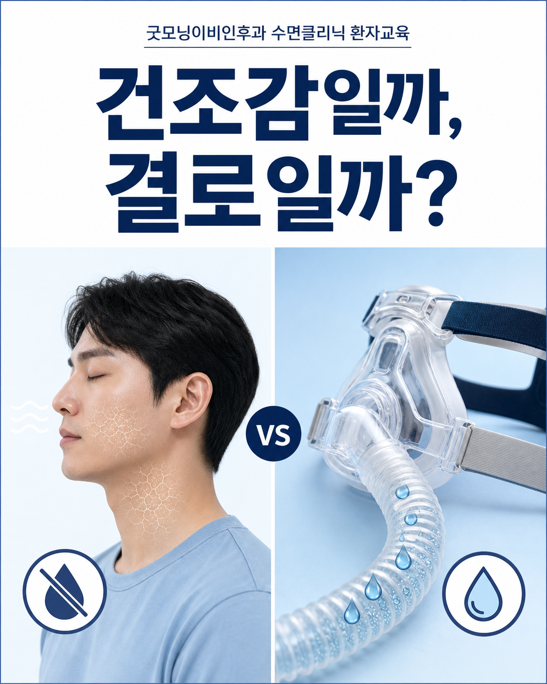 양압기 사용 중 코와 입의 건조감과 호스 결로의 차이