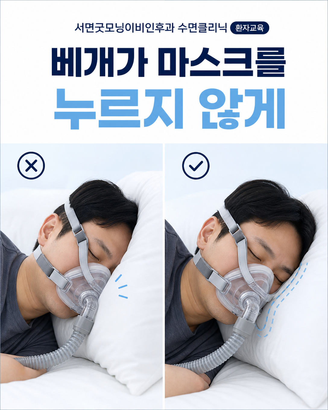 베개가 양압기 마스크를 누르지 않도록 옆잠 자세를 조정하는 방법