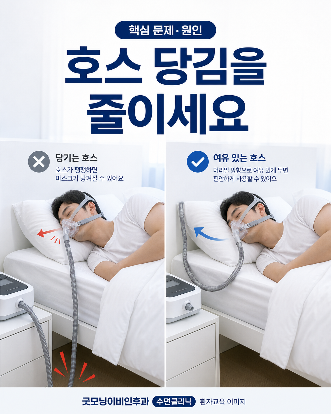 양압기 호스의 당김을 줄일 수 있는 침대 위 호스 배치 비교