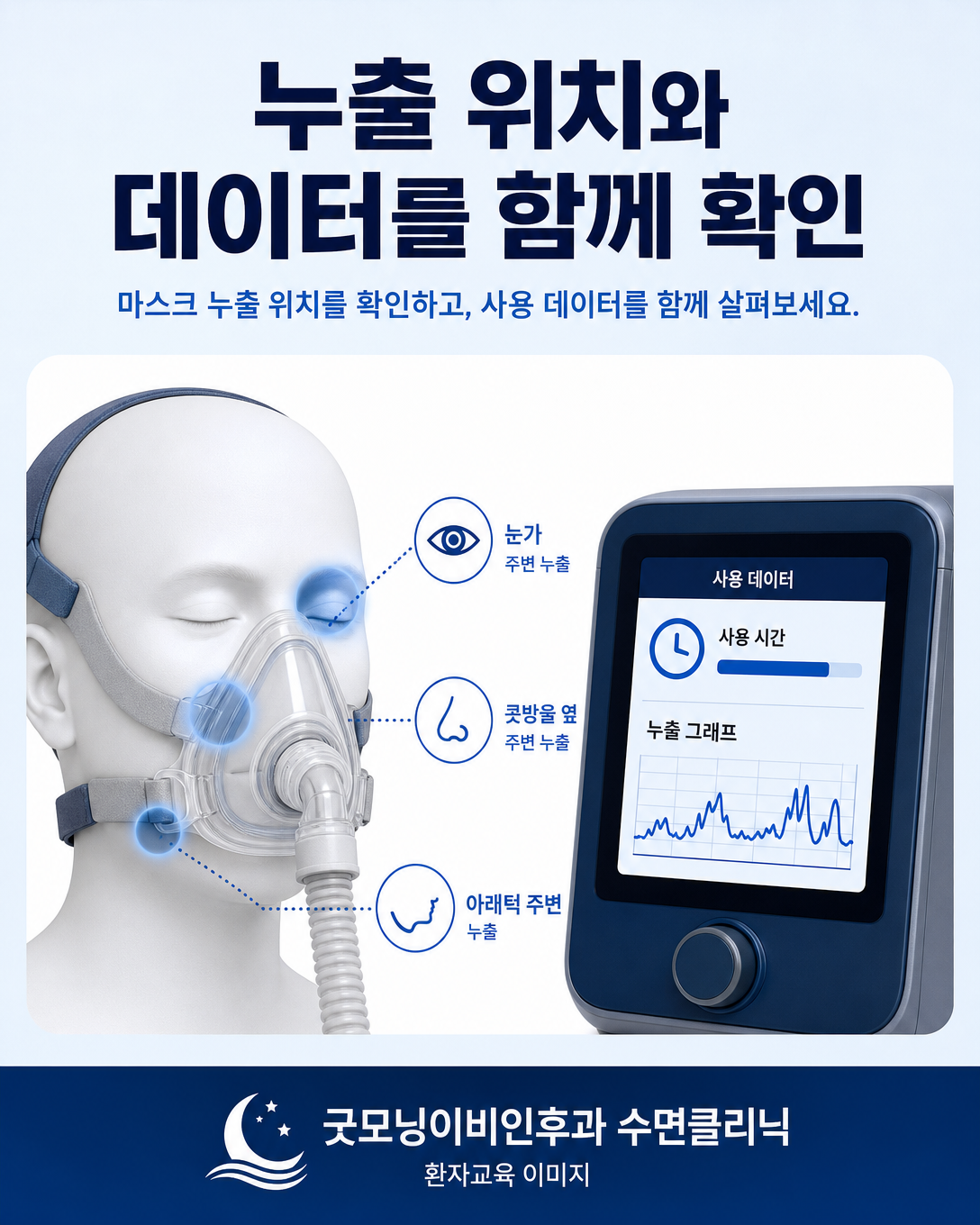 양압기 마스크 누출 위치와 기기 데이터를 함께 확인하는 도식