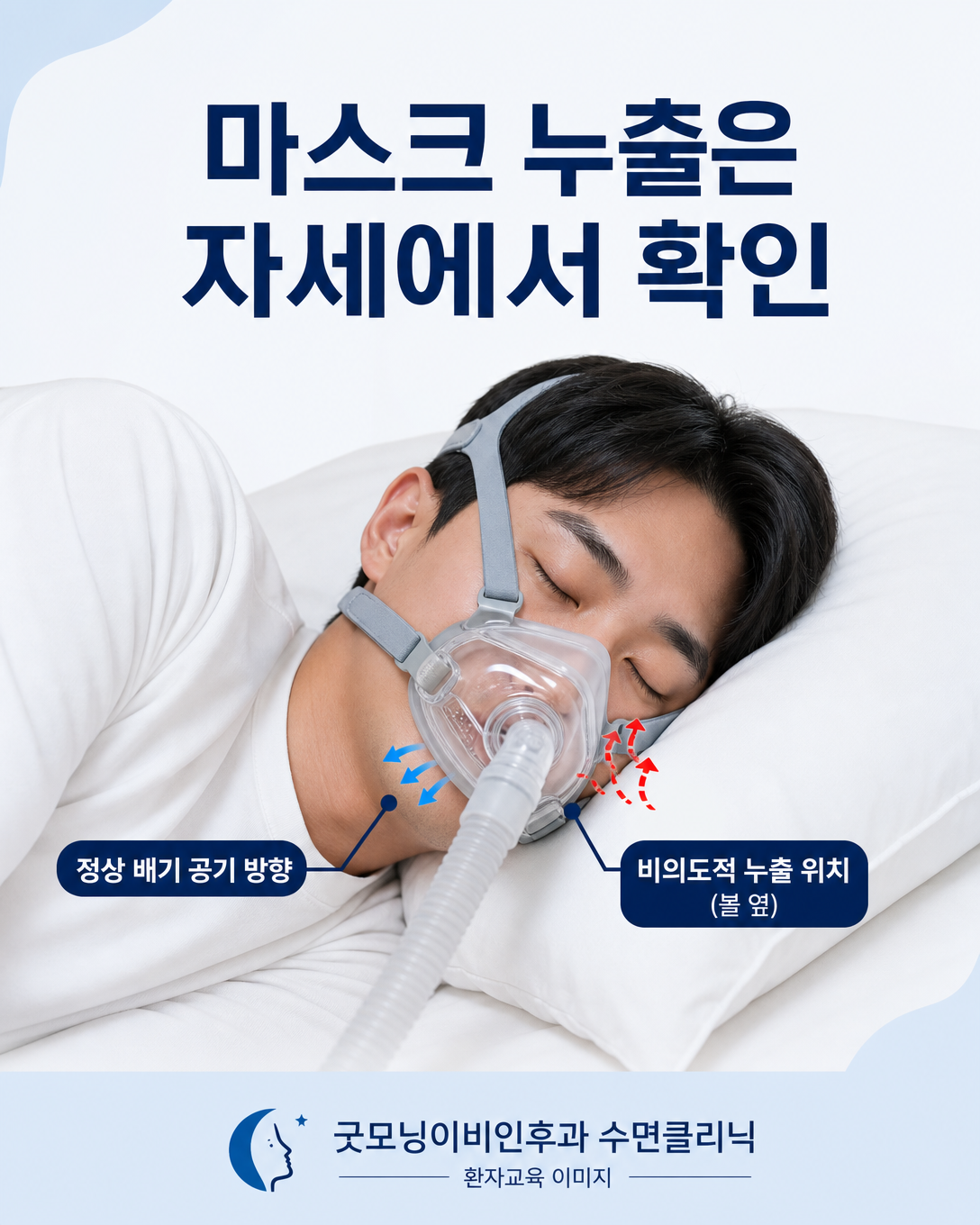 수면 자세에서 양압기 마스크 누출 위치를 확인하는 방법