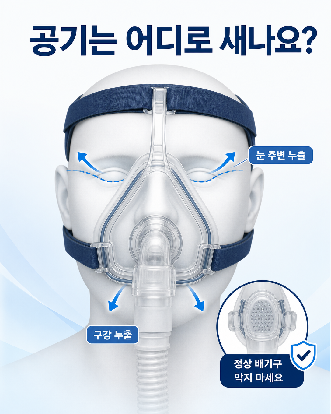 양압기 마스크 가장자리 누출과 입으로 새는 구강 누출을 구분한 도식