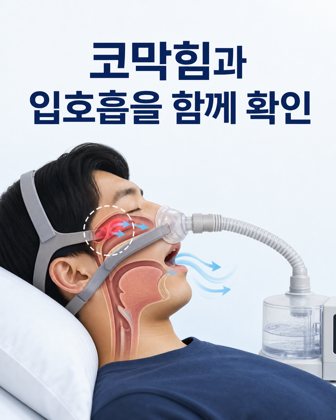 코막힘과 입호흡이 양압기 누출과 코골이에 미치는 영향을 설명한 이미지