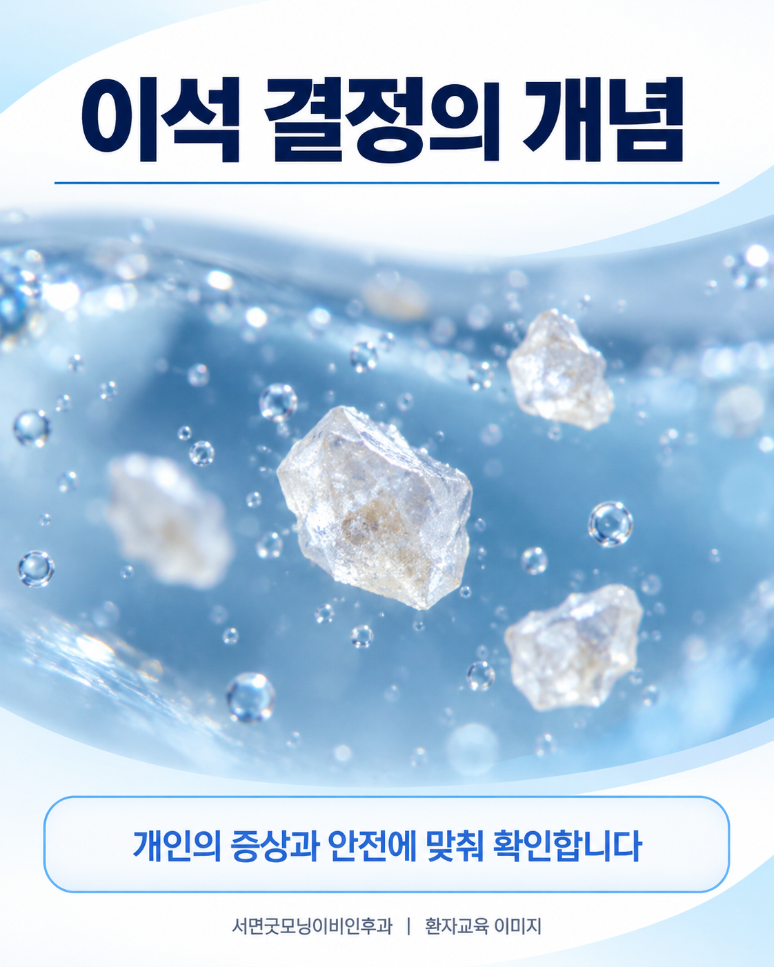 작은 결정과 액체를 표현한 이석 이해용 개념 그림