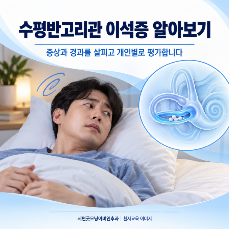 수평반고리관 이석증은 왜 에플리법과 다른 치료를 하나요?
