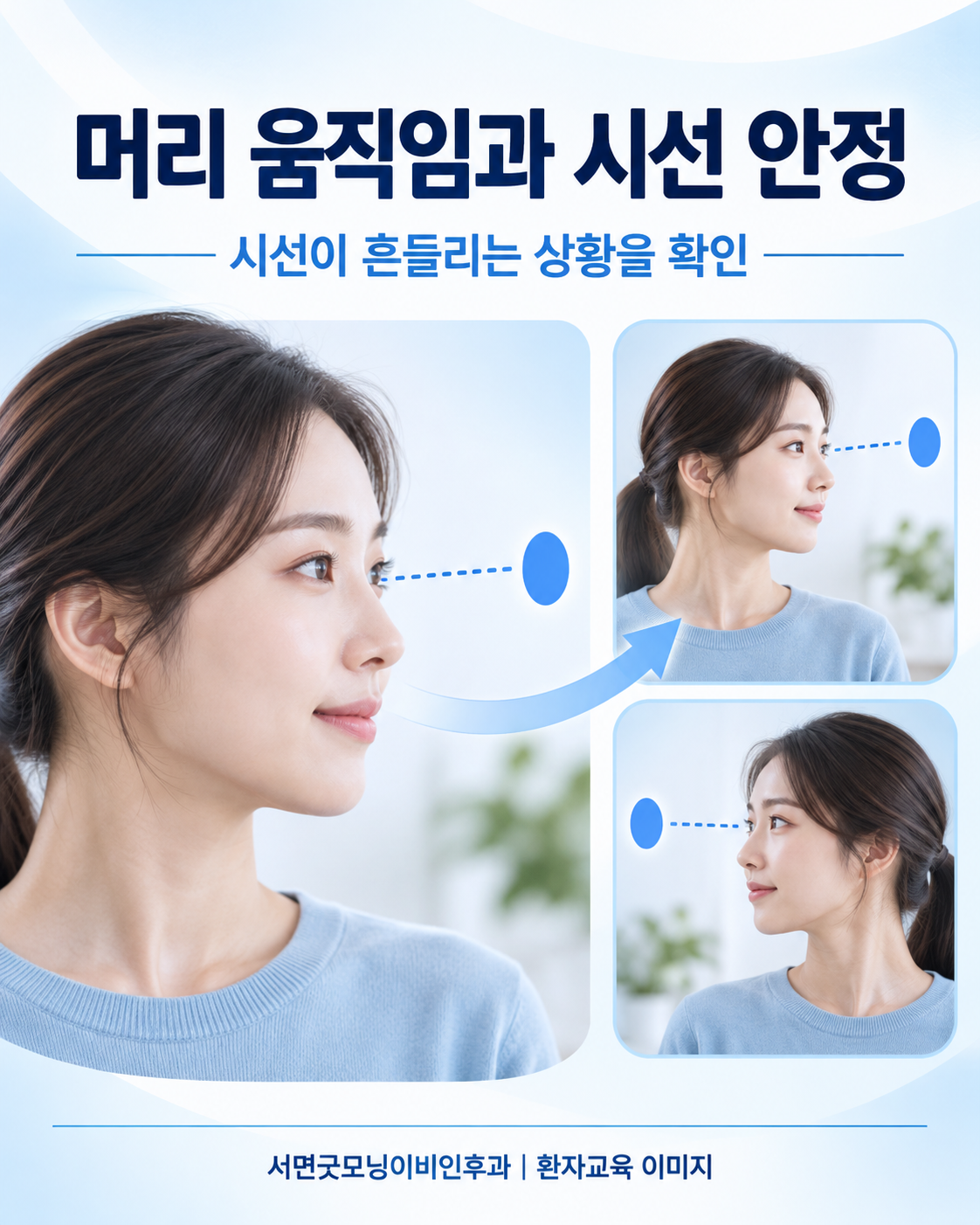 머리 움직임과 시선 안정의 관계를 단순화한 개념 그림