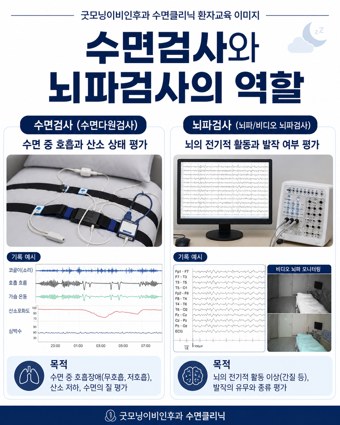 수면다원검사와 비디오 뇌파검사의 서로 다른 평가 목적을 비교한 이미지