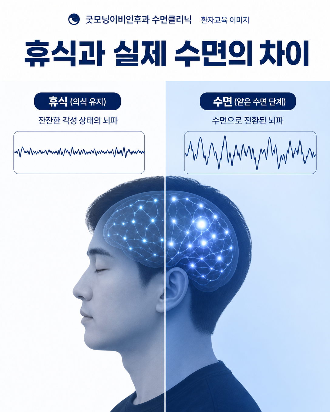 눈을 감고 깨어 있는 휴식과 수면 단계에 들어간 낮잠의 차이
