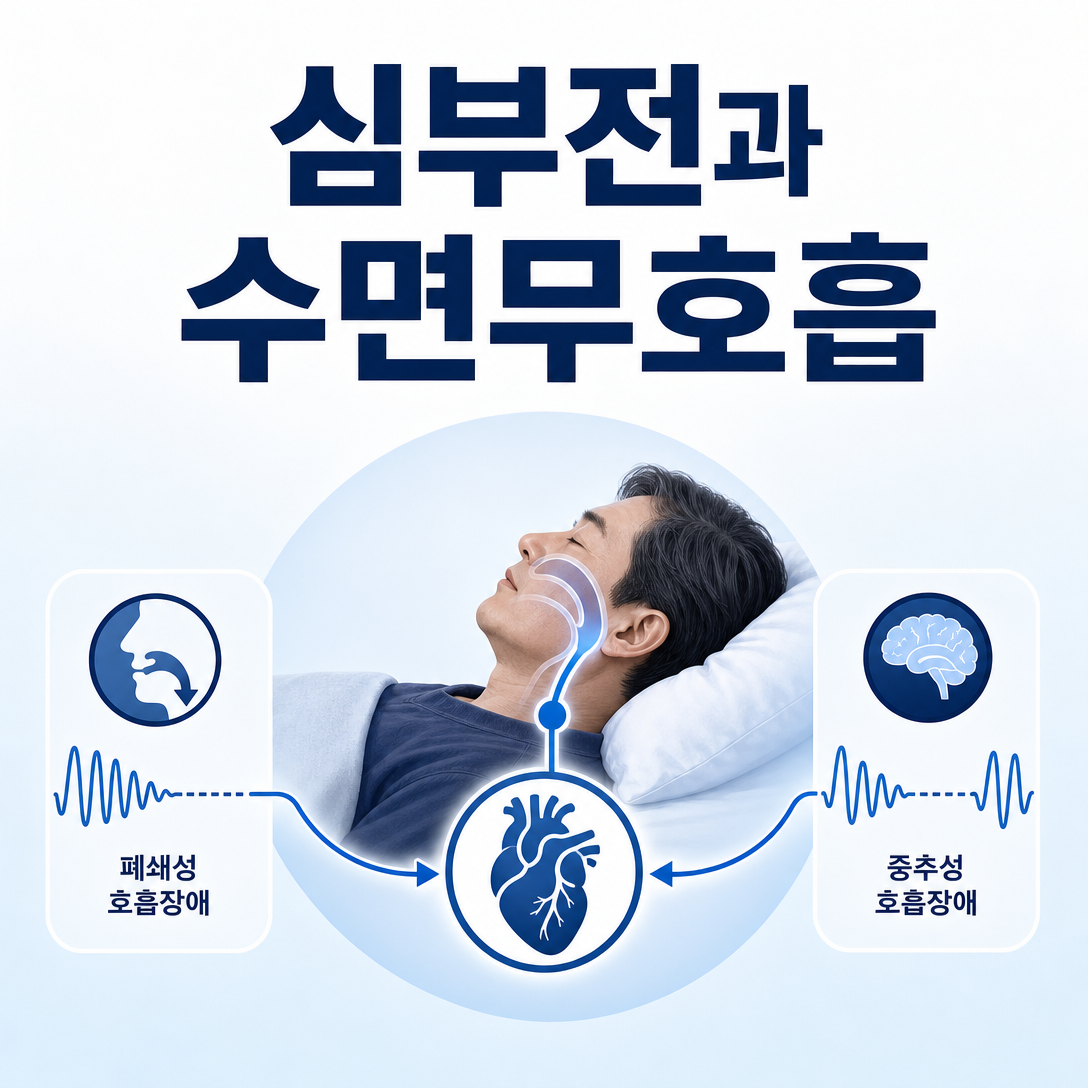 심부전 환자에서 폐쇄성·중추성 수면무호흡을 함께 평가해야 함을 보여주는 대표 이미지