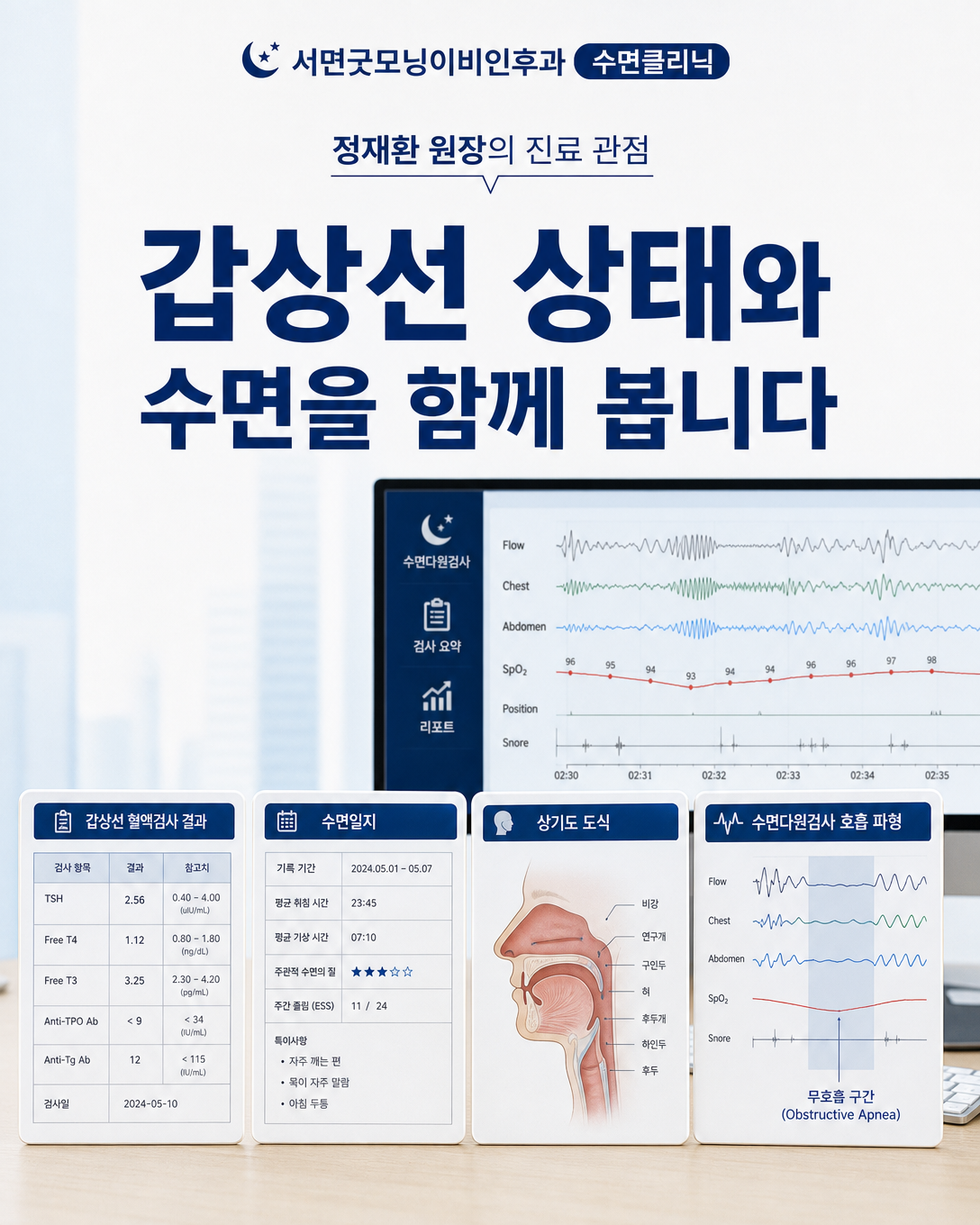 갑상선 검사 결과와 수면일지, 상기도 상태, 수면검사 결과를 함께 검토하는 진료 관점 이미지