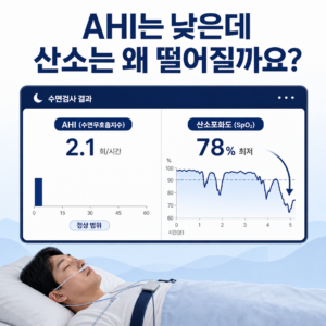 AHI는 낮지만 산소포화도 곡선이 크게 내려가는 수면검사 결과를 비교한 대표 이미지